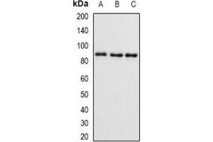 Western blot analysis of SMYD4 expression in mouse brain (A), mouse ovary (B), rat kidney (C) whole cell lysates. (SMYD4 Antikörper)