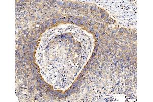 IHC analysis of RPL8 using anti-RPL8 antibody (ABIN7601179). (RPL8 Antikörper  (AA 3-257))