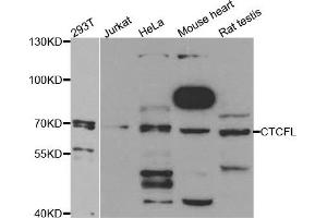 Western Blotting (WB) image for anti-CCCTC-Binding Factor (Zinc Finger Protein)-Like (CTCFL) antibody (ABIN1877135) (CTCFL Antikörper)