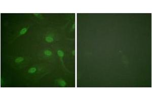 Immunofluorescence analysis of HeLa cells, using Chk1 (Phospho-Ser301) Antibody. (CHEK1 Antikörper  (pSer301))