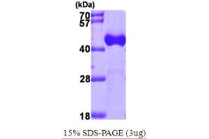 Acetyl-CoA Acyltransferase 1 (ACAA1) (AA 27-424) protein (His tag)