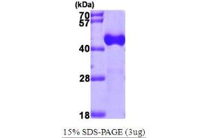 SDS-PAGE (SDS) image for Acetyl-CoA Acyltransferase 1 (ACAA1) (AA 27-424) protein (His tag) (ABIN667183) (ACAA1 Protein (AA 27-424) (His tag))