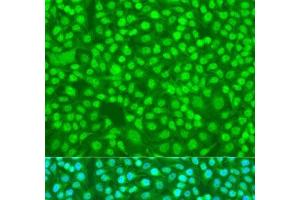 Immunofluorescence analysis of U2OS cells using SFRS9 Polyclonal Antibody at dilution of 1:100. (SFRS9 Antikörper)