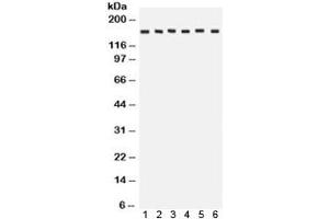 Western blot testing of 1) rat brain, 2) rat liver, 3) human HeLa, 4) CEM, 5) A549 and 6) MCF7 lysate with ROCK2 antibody. (ROCK2 Antikörper  (AA 652-923))