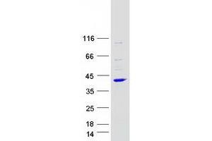 Validation with Western Blot (ARPC2 Protein (Transcript Variant 2) (Myc-DYKDDDDK Tag))