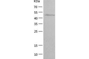 Western Blotting (WB) image for GTPase Activating Protein (SH3 Domain) Binding Protein 2 (G3BP2) (AA 1-449) protein (His tag) (ABIN7123228) (G3BP2 Protein (AA 1-449) (His tag))