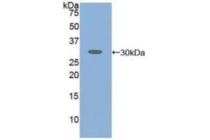 Detection of Recombinant ATXN1, Human using Polyclonal Antibody to Ataxin 1 (ATXN1) (Ataxin 1 Antikörper  (AA 569-807))