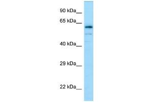 Western Blotting (WB) image for anti-Dihydropyrimidinase-Like 4 (DPYSL4) (C-Term) antibody (ABIN2790103) (DPYSL4 Antikörper  (C-Term))
