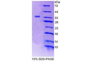SDS-PAGE (SDS) image for Tumor Protein P53 (TP53) (AA 90-354) protein (His tag) (ABIN2127147)