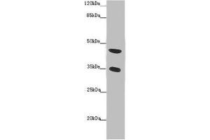 Western blot All lanes: TENT5C antibody at 2 μg/mL + Mouse heart tissue Secondary Goat polyclonal to rabbit IgG at 1/10000 dilution Predicted band size: 45 kDa Observed band size: 45, 35 kDa (FAM46C Antikörper  (AA 1-391))