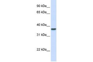 Western Blotting (WB) image for anti-Dimethylarginine Dimethylaminohydrolase 1 (DDAH1) antibody (ABIN2459821) (DDAH1 Antikörper)