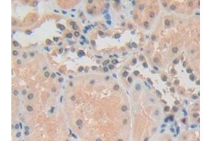 Immunohistochemistry (IHC) image for anti-Adhesion Regulating Molecule 1 (Adrm1) (AA 2-407) antibody (ABIN7443221)