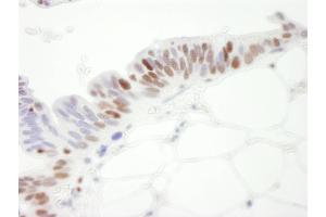 Immunohistochemistry (IHC) image for anti-Minichromosome Maintenance Complex Component 3 (MCM3) (AA 500-550) antibody (ABIN7448651)