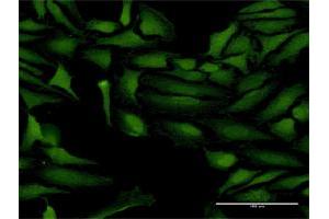 Immunofluorescence of purified MaxPab antibody to ProSAPiP1 on HeLa cell. (ProSAPiP1 Antikörper  (AA 1-673))