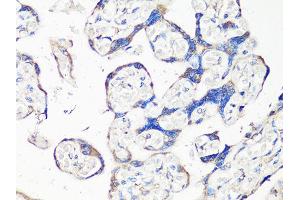 Immunohistochemistry of paraffin-embedded human placenta using MMP2 Antibody (ABIN5998246) at dilution of 1/100 (40x lens). (MMP2 Antikörper)