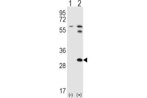 Western Blotting (WB) image for anti-Signal Transducing Adaptor Family Member 1 (STAP1) antibody (ABIN2998216)
