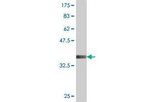 Western Blot detection against Immunogen (37. (RFPL4B Antikörper  (AA 127-226))
