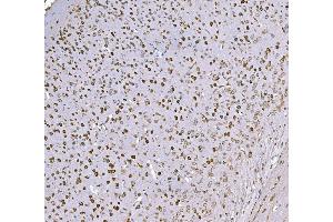 IHC analysis of SND1 using anti-SND1 antibody (ABIN7600526). (SND1 Antikörper  (AA 20-204))