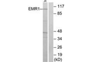 Western blot analysis of extracts from Jurkat cells, using EMR1 Antibody. (F4/80 Antikörper  (AA 818-867))