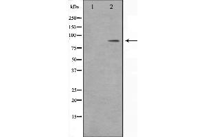 Western blot analysis on HeLa cell lysate using BARD1 Antibody,The lane on the left is treated with the antigen-specific peptide. (DMC1 Antikörper  (Internal Region))