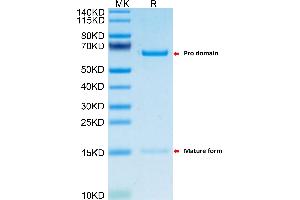 Mouse PCSK9 on Tris-Bis PAGE under reduced condition. (PCSK9 Protein (AA 35-694) (His tag))