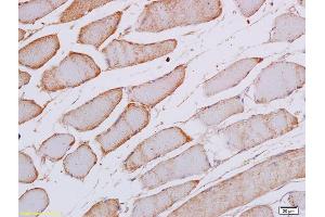 Formalin-fixed and paraffin embedded rat skeletal muscle labeled with Anti Phospho-SEK1/MKK4 (Thr261) Polyclonal Antibody, Unconjugated (ABIN702745) at 1:200 followed by conjugation to the secondary antibody and DAB staining (MAP2K4 Antikörper  (pThr261))