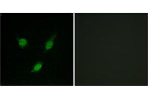 Immunofluorescence analysis of MCF7 cells, using TACC1 Antibody. (TACC1 Antikörper  (AA 11-60))