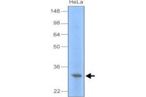 Western blot analysis of cell lysate of HeLa (30 ug) were resolved by SDS - PAGE , transferred to PVDF membrane and probed with UNG monoclonal antibody , clone k1C12 (1 : 1000) . (UNG Antikörper)