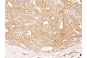 anti-Dynein, Cytoplasmic 1, Light Intermediate Chain 1 (DYNC1LI1) (AA 1-50) antibody