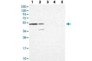 Western blot analysis of Lane 1: RT-4, Lane 2: U-251 MG, Lane 3: Human Plasma, Lane 4: Liver, Lane 5: Tonsil with C16orf88 polyclonal antibody  at 1:100-1:250 dilution. (KNOP1 Antikörper)