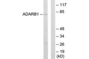 Western blot analysis of extracts from HepG2 cells, using ADARB1 Antibody. (RED1 Antikörper  (AA 481-530))
