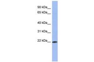Image no. 1 for anti-RNA Binding Motif Protein 38 (RBM38) (C-Term) antibody (ABIN6743016) (RBM38 Antikörper  (C-Term))
