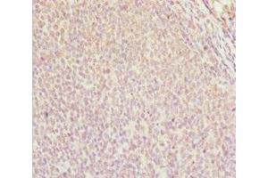 Immunohistochemistry of paraffin-embedded human tonsil tissue using ABIN7144963 at dilution of 1:100 (DDX11 Antikörper  (AA 1-220))
