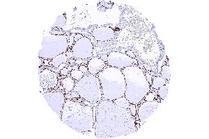 Thyroid gland with strong TTF1 staining of follicular epithelial cells (Rekombinanter NKX2-1 Antikörper)