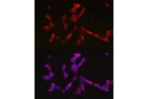 Immunofluorescence analysis of SH-SY5Y cells using ALK antibody  at dilution of 1:200. (ALK Antikörper  (AA 19-300))