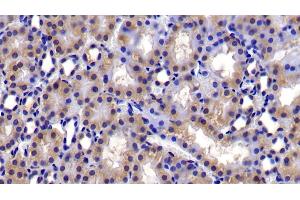 Immunohistochemistry (IHC) image for anti-BCL2-Like 1 (BCL2L1) (AA 2-212) antibody (ABIN7437179)