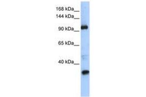 Image no. 1 for anti-Terminal Uridylyl Transferase 1, U6 SnRNA-Specific (TUT1) (AA 829-878) antibody (ABIN6740612) (TUT1 Antikörper  (AA 829-878))