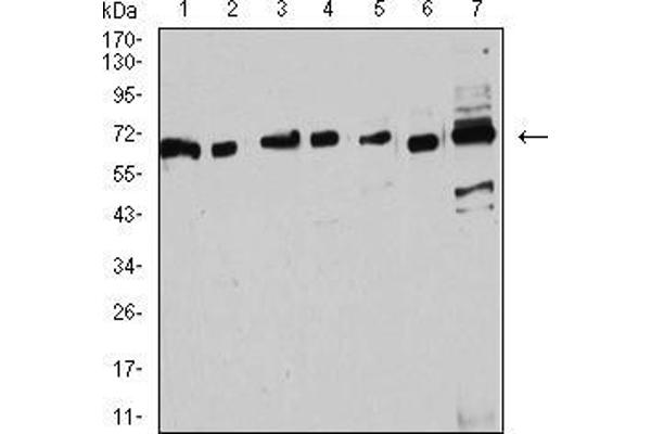 Estrogen Receptor alpha Antikörper  (AA 2-185)