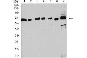 Western blot analysis using ESR1 mouse mAb against MOLT4 (1), Raji (2), MCF-7 (3), T47D (4), SK-Br-3 (5), Hela (6), and C6 (7) cell lysate.