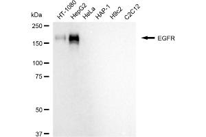 Western blotting analysis using EGFR antibody (ABIN7798480).