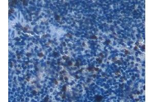 Immunohistochemistry (IHC) image for anti-R-Spondin 1 (RSPO1) (AA 21-135) antibody (ABIN7430147)