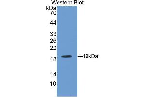 Western blot analysis of the recombinant protein. (CFP Antikörper  (AA 54-217))