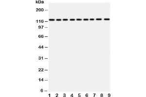 Western blot testing of TRPC3 antibody and Lane 1:  rat liver;  2: (r) lung;  3: (r) intestine;  4: (r) ovary;  5: human U87;  6: (h) A549;  7: (h) COLO320;  8: (h) SW620;  9: (h) HeLa (TRPC3 Antikörper  (AA 836-851))