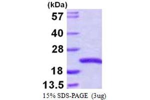 SDS-PAGE (SDS) image for Sorting Nexin 3 (SNX3) (AA 1-162) protein (His tag) (ABIN667480)
