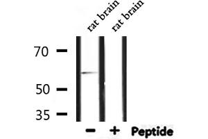 Western blot analysis of extracts from rat brain, using TF2H1 Antibody. (GTF2H1 Antikörper  (N-Term))