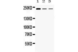 Western Blotting (WB) image for anti-Tectorin alpha (TECTA) (AA 93-134), (N-Term) antibody (ABIN5518790)