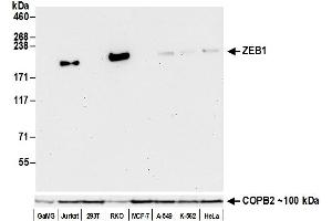 Western Blotting (WB) image for anti-Zinc Finger E-Box Binding Homeobox 1 (ZEB1) (AA 1074-1124) antibody (ABIN7453320)