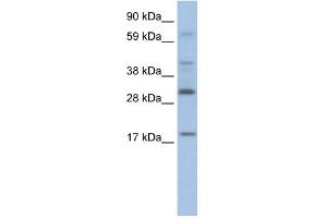 WB Suggested Anti-PYCARD Antibody Titration:  2. (PYCARD Antikörper  (Middle Region))