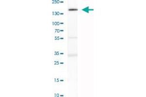 Western Blot analysis of SH-SY5Y cell lysate with TULP4 polyclonal antibody .