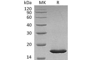 Western Blotting (WB) image for Leptin (LEP) protein (His tag) (ABIN7321015) (Leptin Protein (LEP) (His tag))